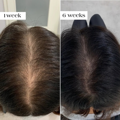 Feliora Hair Regrowth System