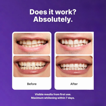 Feliora™ Purple Whitening Strips