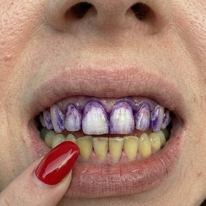 Feliora™ Purple Whitening Strips