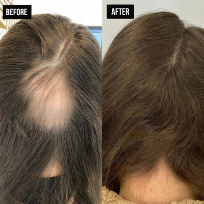 Feliora Hair Regrowth System